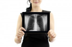 Learn about lung cancer. Image of woman holding chest x-ray.