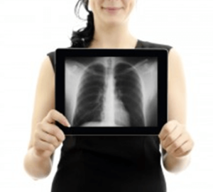 Diagnosing lung cancer may include a number of medical tests.